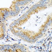 Anti-COPA antibody produced in rabbit