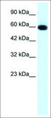 Anti-GLIS2 antibody produced in rabbit affinity isolated antibody