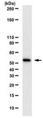 Anti-phospho-AKT1 Antibody, Thr479 from rabbit, purified by affinity chromatography