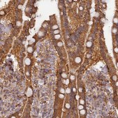 Anti-RPIA antibody produced in rabbit Prestige Antibodies® Powered by Atlas Antibodies, affinity isolated antibody, buffered aqueous glycerol solution