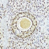 Anti-Phospho-Histone H3-T11 antibody produced in rabbit
