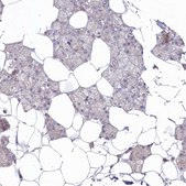 Anti-ARSB antibody produced in rabbit Prestige Antibodies® Powered by Atlas Antibodies, affinity isolated antibody, buffered aqueous glycerol solution