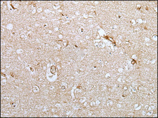 Anti-HOXC9 affinity isolated antibody