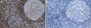 Ani-APPL1 Antibody, clone 2K17 ZooMAb® Rabbit Monoclonal recombinant, expressed in HEK 293 cells