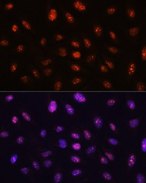 Anti- RB antibody produced in rabbit