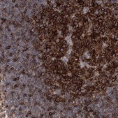 Anti-FAM167A antibody produced in rabbit Prestige Antibodies® Powered by Atlas Antibodies, affinity isolated antibody, buffered aqueous glycerol solution
