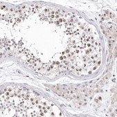 Anti-CDCA8 antibody produced in rabbit Prestige Antibodies® Powered by Atlas Antibodies, affinity isolated antibody, buffered aqueous glycerol solution