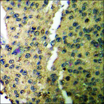 Anti-phospho-CaMK1-&#945; (pThr177) antibody produced in rabbit affinity isolated antibody