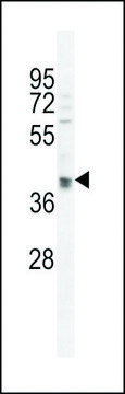 ANTI-OTUD3 (CENTER) antibody produced in rabbit affinity isolated antibody, buffered aqueous solution