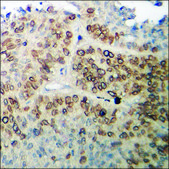 Anti-phospho-CaMK1-α (pThr177) antibody produced in rabbit affinity isolated antibody