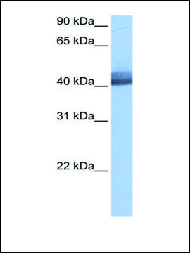 Anti-RBM4 (AB2) antibody produced in rabbit affinity isolated antibody