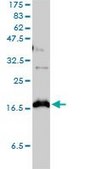 Monoclonal Anti-CLDN1 antibody produced in mouse clone 1C5-D9, purified immunoglobulin, buffered aqueous solution