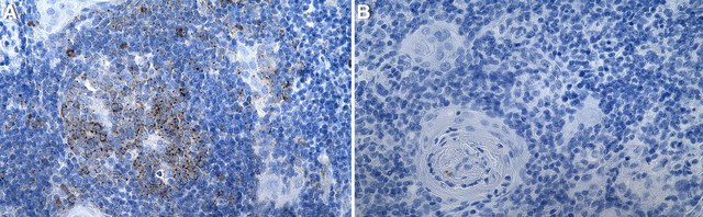 Anti-MX1/MxA Antibody, clone 2C20 ZooMAb&#174; Rabbit Monoclonal recombinant, expressed in HEK 293 cells