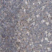 Anti-LRBA antibody produced in rabbit Prestige Antibodies® Powered by Atlas Antibodies, affinity isolated antibody, buffered aqueous glycerol solution, Ab1