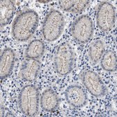 Anti-CRB3 antibody produced in rabbit Prestige Antibodies® Powered by Atlas Antibodies, affinity isolated antibody, buffered aqueous glycerol solution