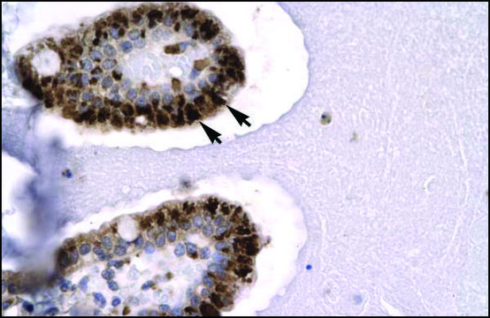 Anti-SIRT5 antibody produced in rabbit affinity isolated antibody