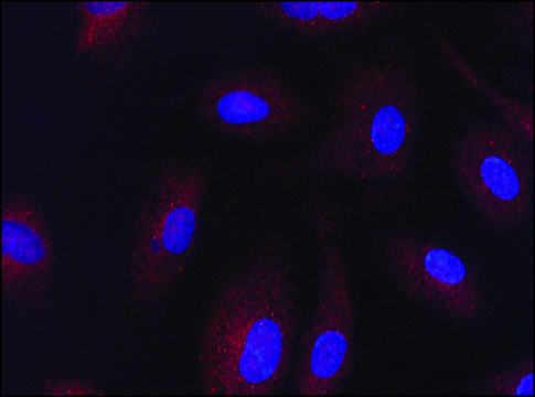 Anti-Sirt3 antibody produced in rabbit affinity isolated antibody, buffered aqueous solution