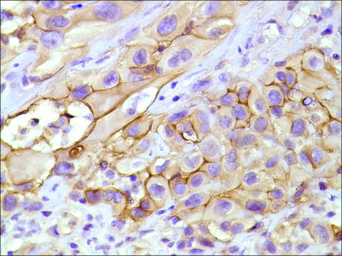 Anti-Mesothelin antibody, Rabbit monoclonal recombinant, expressed in proprietary host, clone SP74, affinity isolated antibody