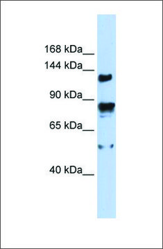 抗TRPM4 兔抗 affinity isolated antibody