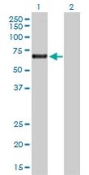 Anti-ACD antibody produced in rabbit purified immunoglobulin, buffered aqueous solution