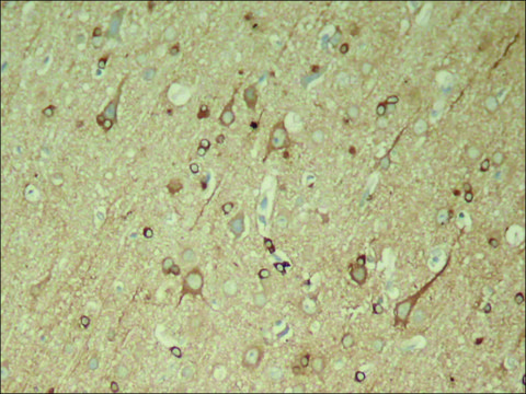 Anti-phospho-MAPT (pSer396) antibody produced in rabbit affinity isolated antibody