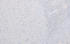 CDK4 (DCS-31) Mouse Monoclonal Antibody