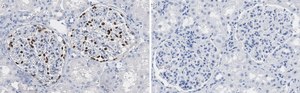 Anti-Wilms Tumor Protein Antibody, clone 2O18 ZooMAb® Rabbit Monoclonal recombinant, expressed in HEK 293 cells