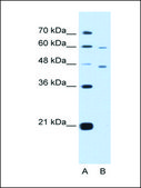 Anti-CRELD1 antibody produced in rabbit IgG fraction of antiserum