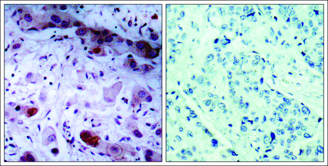 Anti-phospho-JAK1 (pTyr1022) antibody produced in rabbit affinity isolated antibody