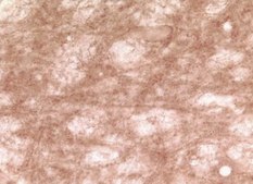 Anti-Synuclein γ Antibody serum, Chemicon®