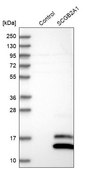 Anti-SCGB2A1 antibody produced in rabbit Prestige Antibodies® Powered by Atlas Antibodies, affinity isolated antibody, buffered aqueous glycerol solution