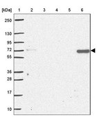 Anti-AP5M1 antibody produced in rabbit Prestige Antibodies® Powered by Atlas Antibodies, affinity isolated antibody, buffered aqueous glycerol solution