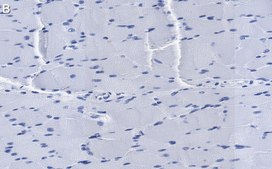 Anti-ACAD10 Antibody, clone 3J20 ZooMAb® Rabbit Monoclonal recombinant, expressed in HEK 293 cells