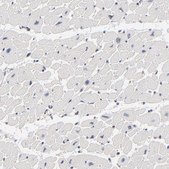 Anti-DSN1 antibody produced in rabbit Prestige Antibodies® Powered by Atlas Antibodies, affinity isolated antibody, buffered aqueous glycerol solution