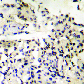 Anti-phospho-MDM4 (pSer367) antibody produced in rabbit affinity isolated antibody