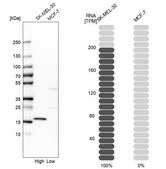 Anti-SNCA antibody produced in rabbit Prestige Antibodies® Powered by Atlas Antibodies, affinity isolated antibody, buffered aqueous glycerol solution