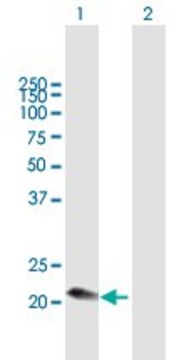 Anti-C1QC antibody produced in mouse purified immunoglobulin, buffered aqueous solution