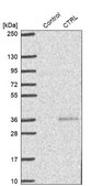 Anti-CTRL antibody produced in rabbit Prestige Antibodies® Powered by Atlas Antibodies, affinity isolated antibody, buffered aqueous glycerol solution
