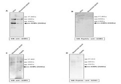 Anti-ACER1 antibody produced in rabbit affinity isolated antibody