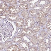 Anti-PYCR2 antibody produced in rabbit Prestige Antibodies® Powered by Atlas Antibodies, affinity isolated antibody, buffered aqueous glycerol solution