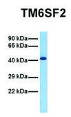 Anti-TM6SF2 (C-terminal) antibody produced in rabbit affinity isolated antibody