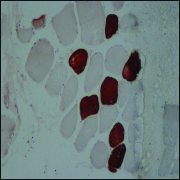 Anti-Myosin (Skeletal, Slow) antibody, Mouse monoclonal clone NOQ7.5.4D, purified from hybridoma cell culture