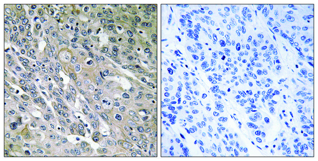 Anti-ARHGEF9 antibody produced in rabbit affinity isolated antibody