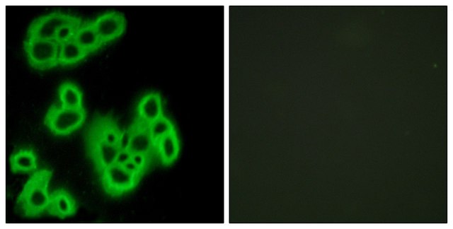 Anti-FPR1 antibody produced in rabbit affinity isolated antibody