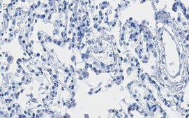 Anti-ITGA3 Antibody, clone 1D6 ZooMAb® Rabbit Monoclonal recombinant, expressed in HEK 293 cells