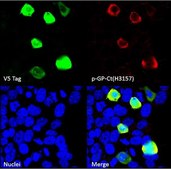 Anti-C9ORF72/C9RANT (GPsense-CT) serum, from rabbit