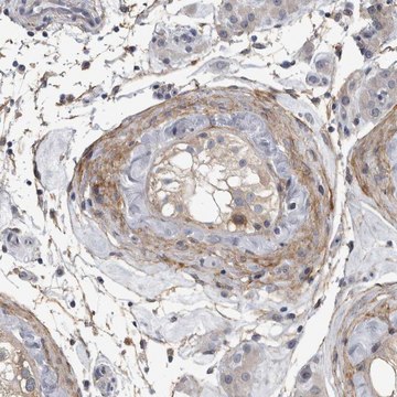 Anti-EFEMP2 antibody produced in rabbit Prestige Antibodies&#174; Powered by Atlas Antibodies, affinity isolated antibody, buffered aqueous glycerol solution