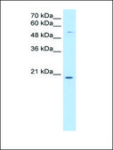 Anti-CHIC2 antibody produced in rabbit affinity isolated antibody