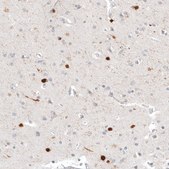 Anti-CALB2 antibody produced in mouse Prestige Antibodies® Powered by Atlas Antibodies, clone CL12842, purified by using Protein A, buffered aqueous glycerol solution
