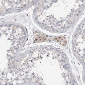 Anti-STRADB antibody produced in rabbit Prestige Antibodies® Powered by Atlas Antibodies, affinity isolated antibody, buffered aqueous glycerol solution